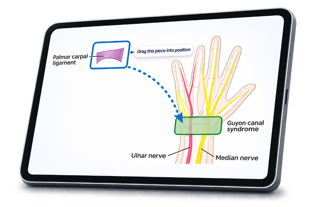 Tablet lesson dragging the palmar carpal ligament into place and identifying the ulnar and median nerves