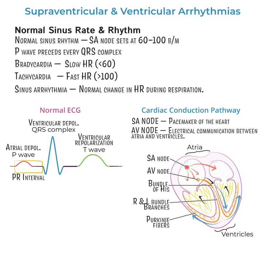 Supraventricular and Ventricular Arrhythmias