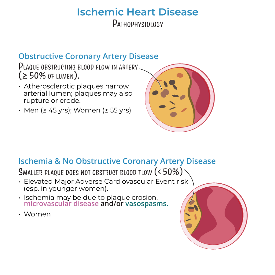 ischemic heart disease, coronary artery disease