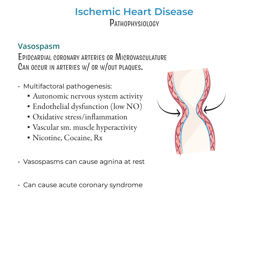 vasospasm, ischemic heart disease