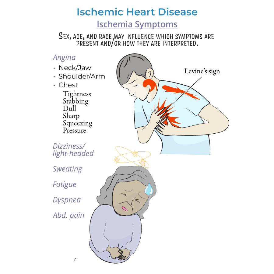 ischemic heart disease symptoms