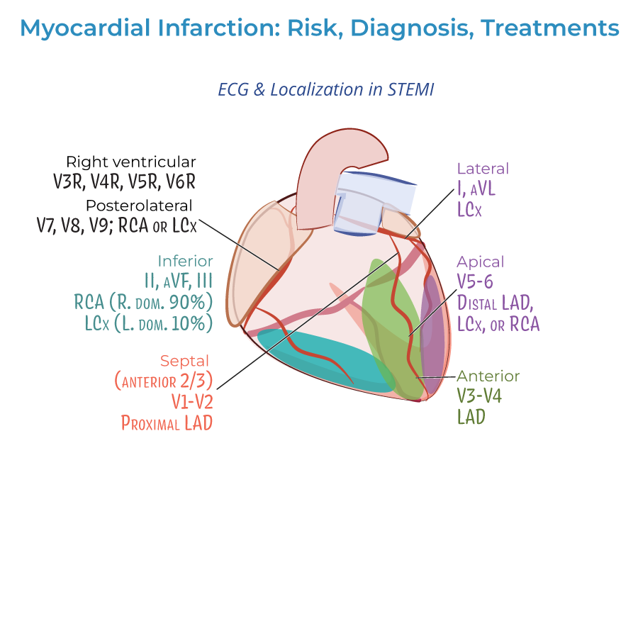 myocardial infarction leads
