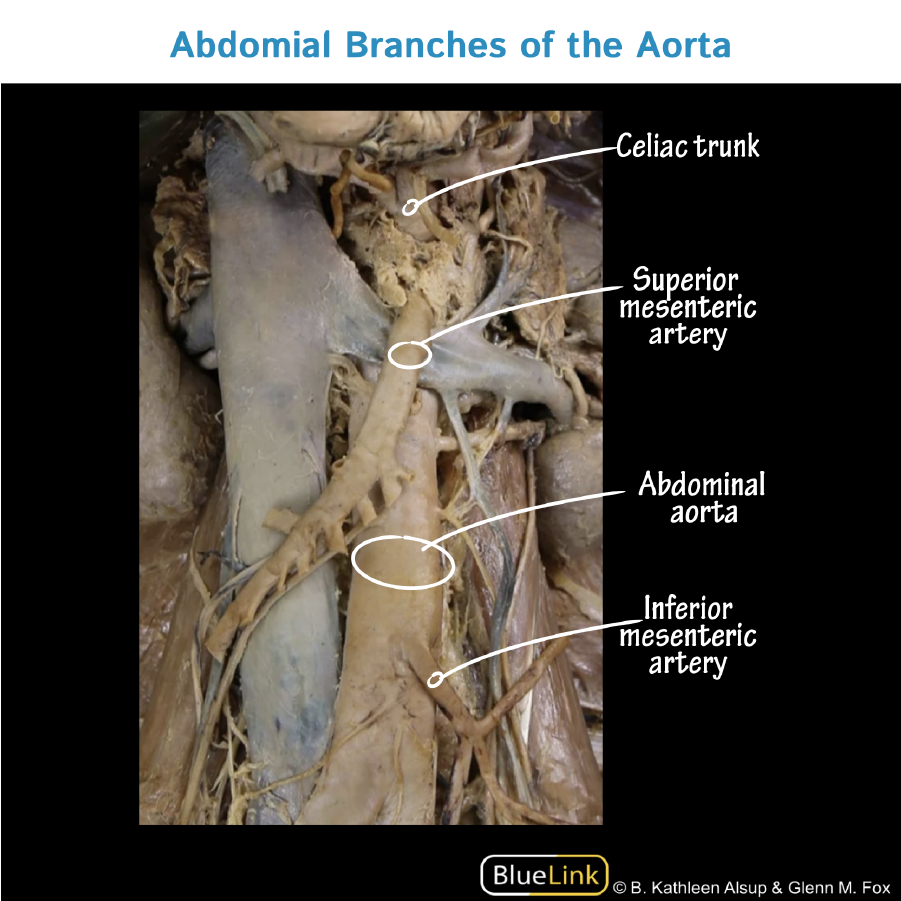 Abdominal Branches of Aorta - Gross Anatomy