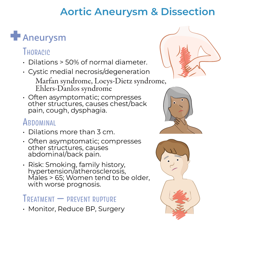 aortic dissection