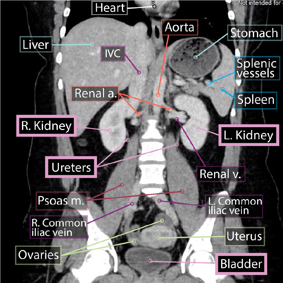 Urinary System Imaging