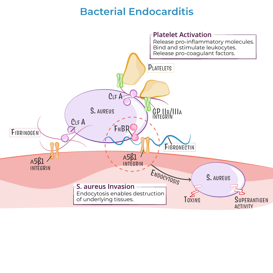Bacterial Endocarditis pathophysiology