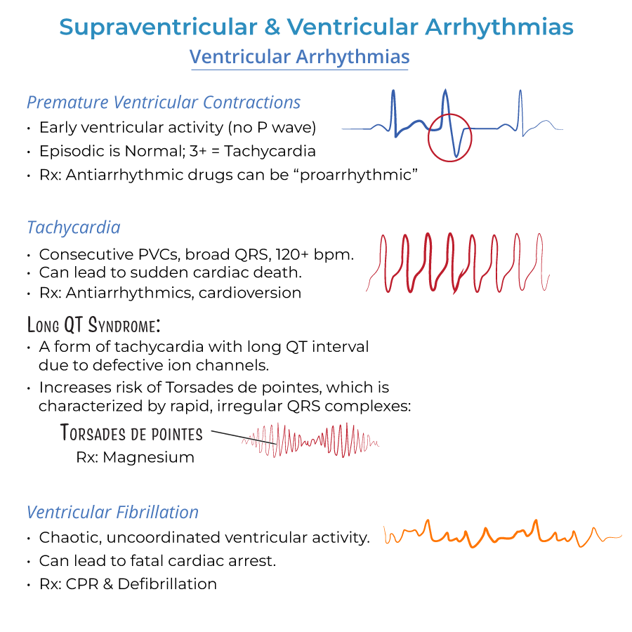 Supraventricular and Ventricular Arrhythmias