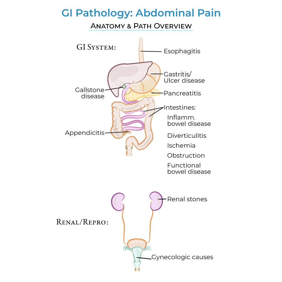 Causes of Abdominal Pain