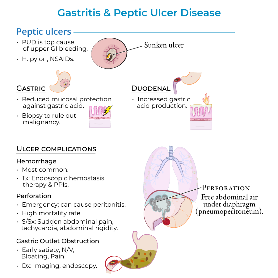 peptic ulcers