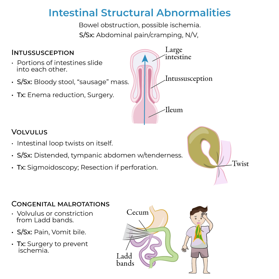 Intussusception, Volvulus, Congenital malformations