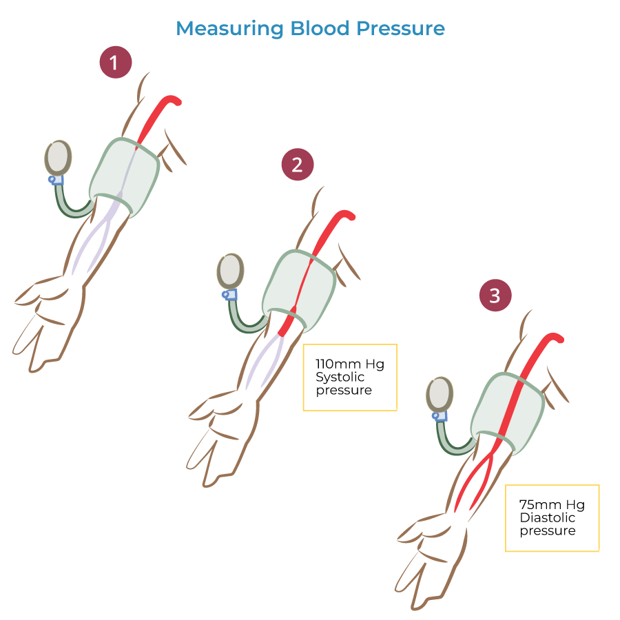 Sphygmomanometer - Measure blood pressure