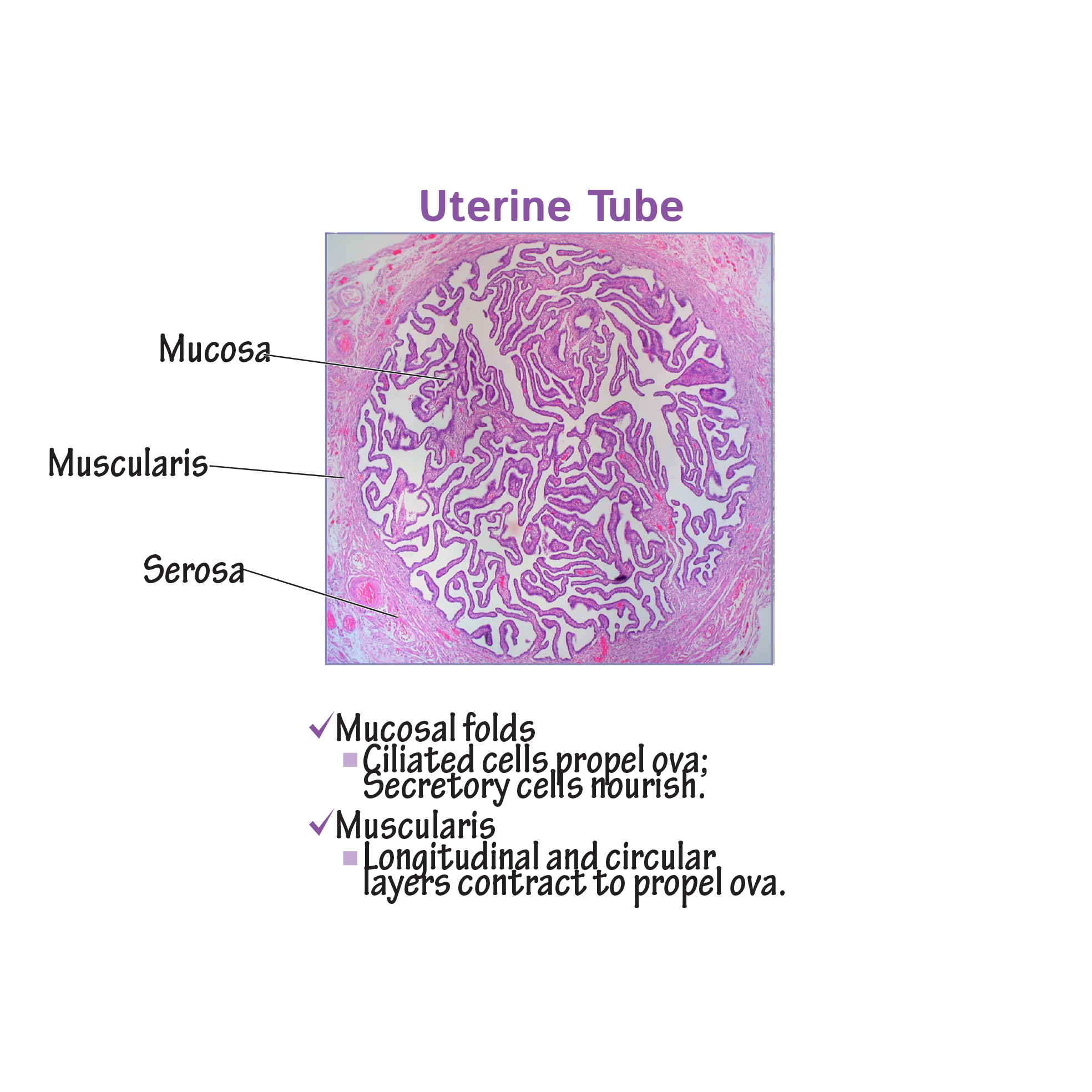 uterine tube histology; fallopian tube histology