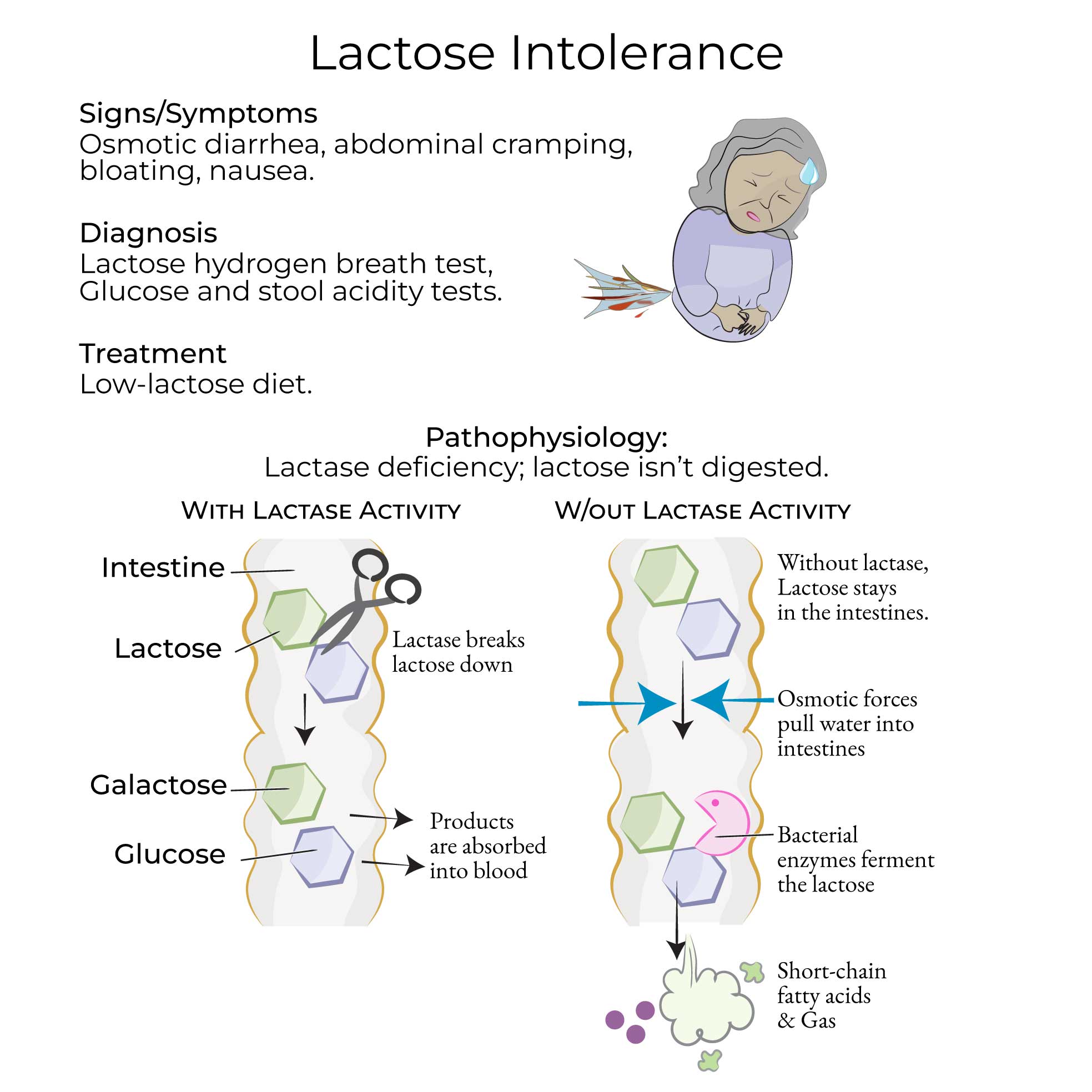 Lactose Intolerance
