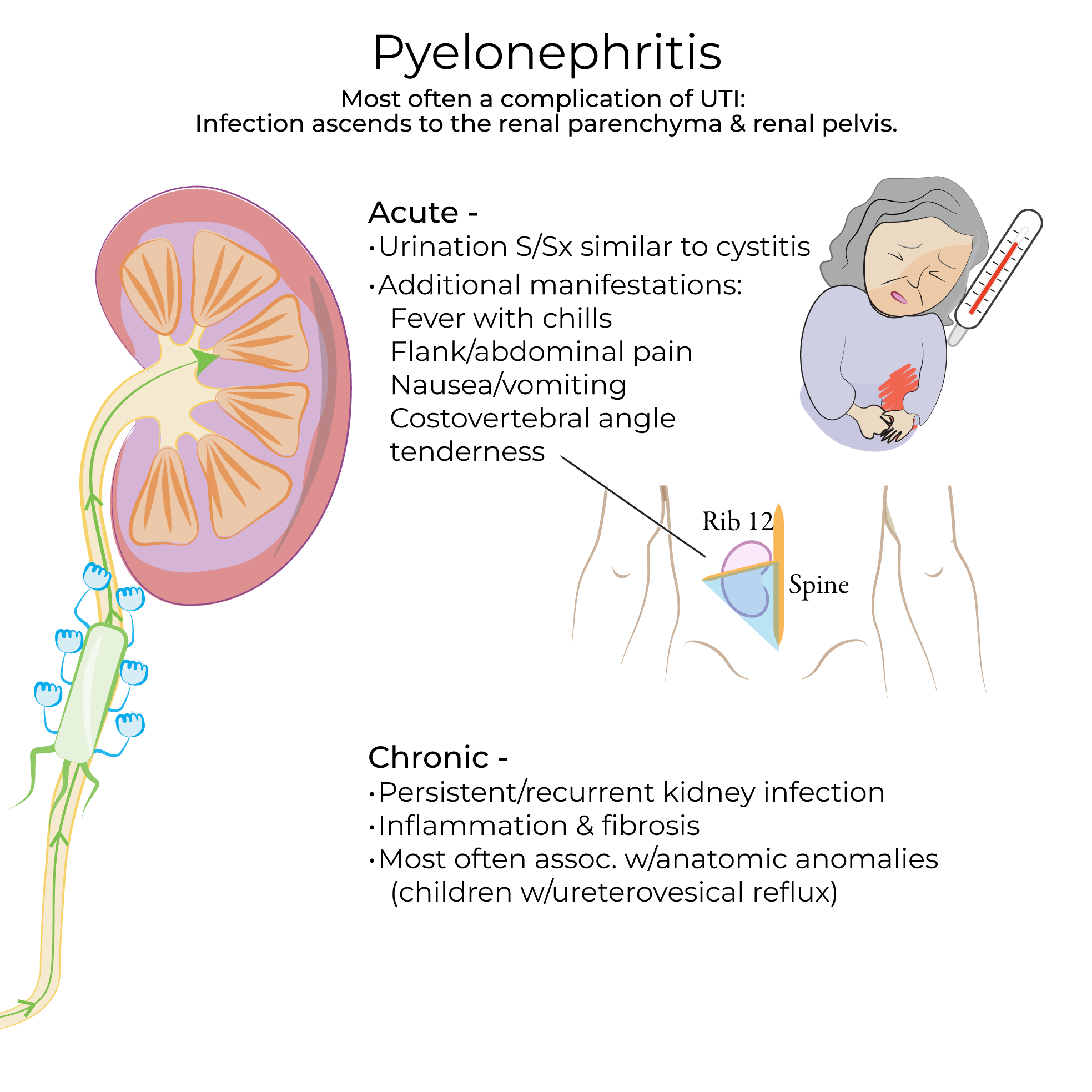 Pyelonephritis