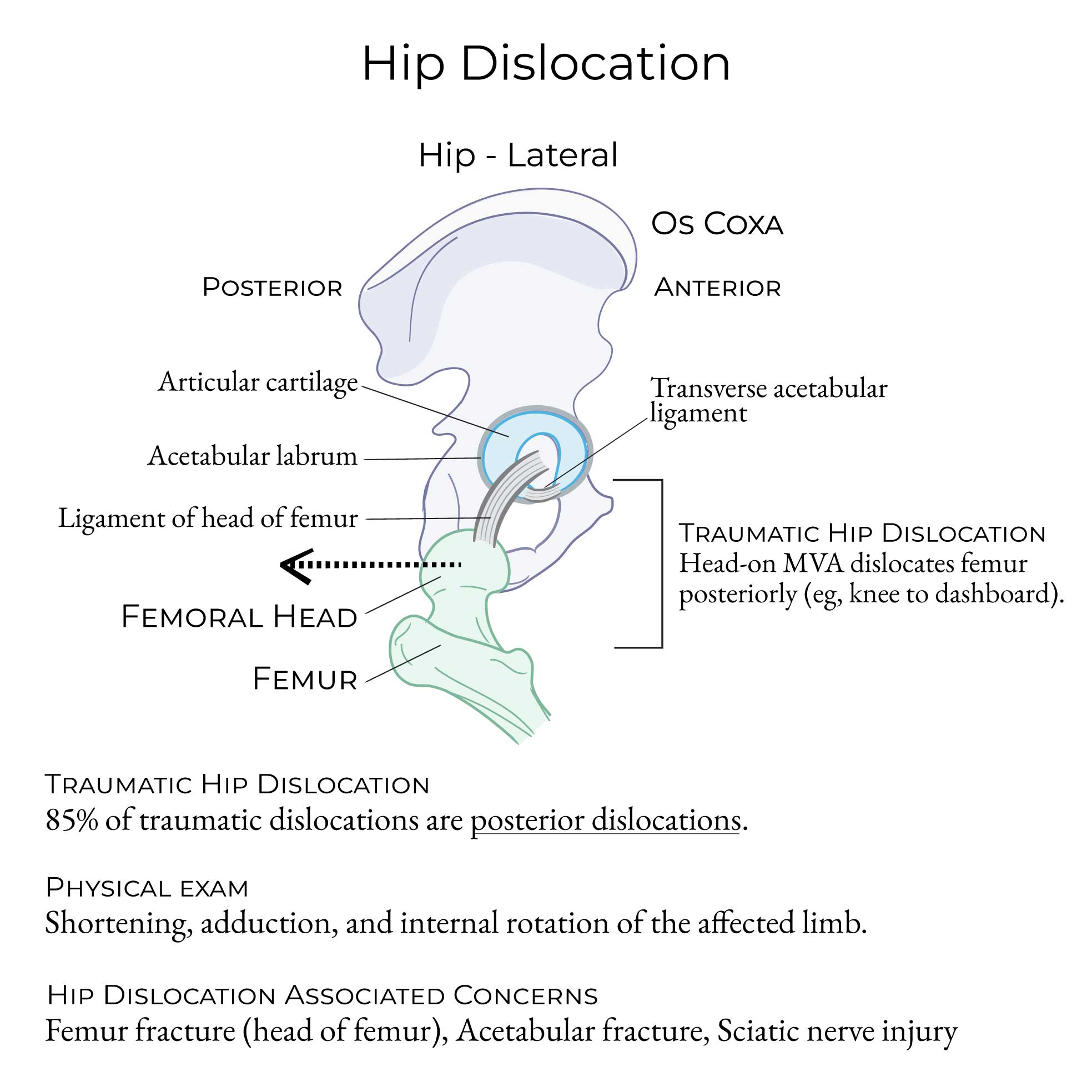 Hip dislocation