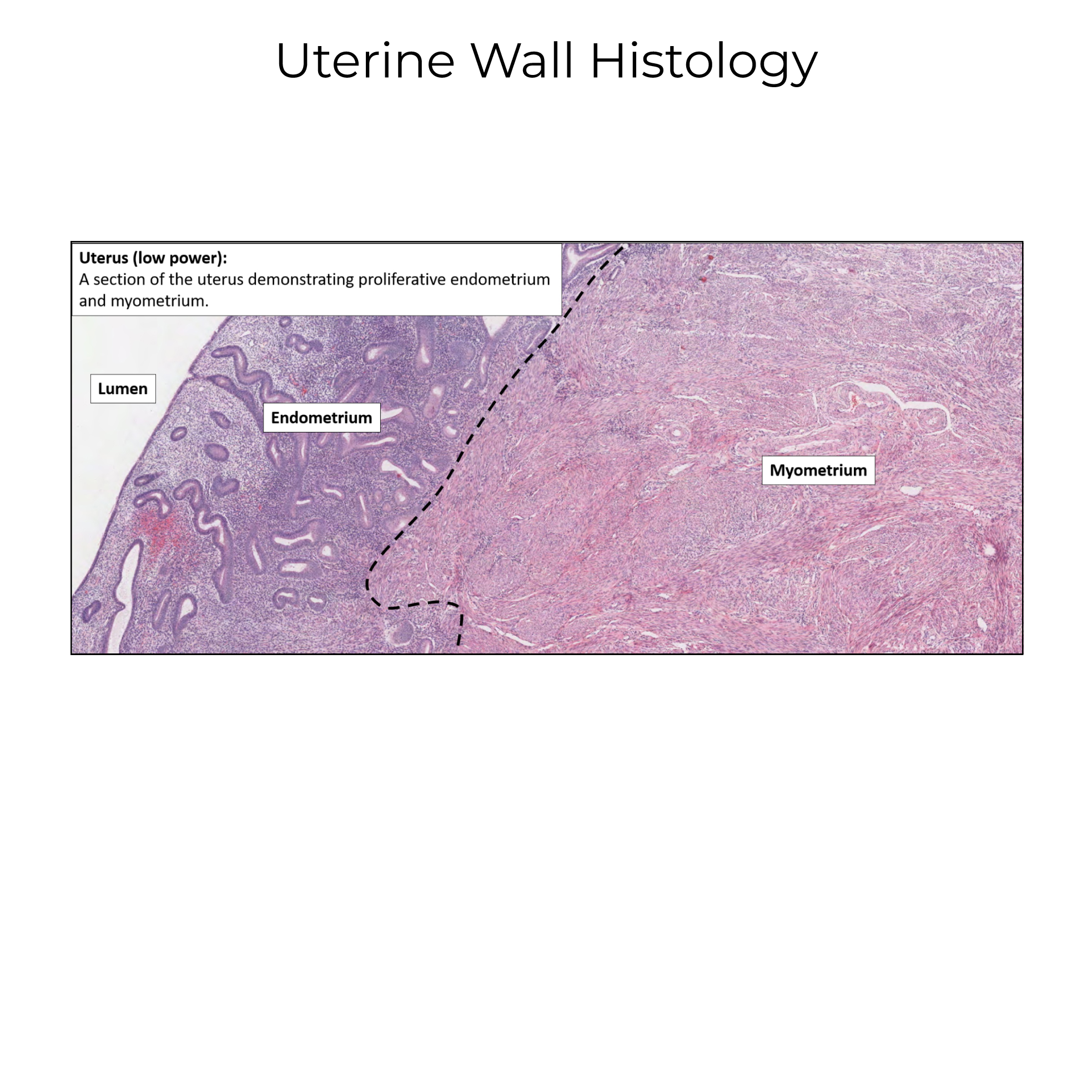 Uterine wall histology - Endometrium, Myometrium