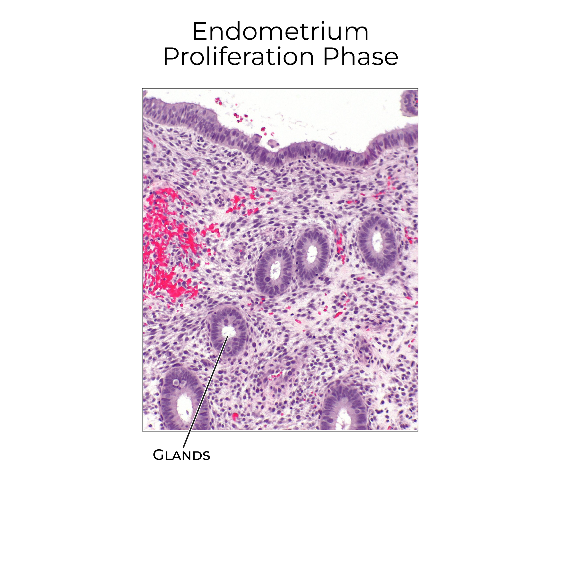 Endometrium, Proliferative Phase