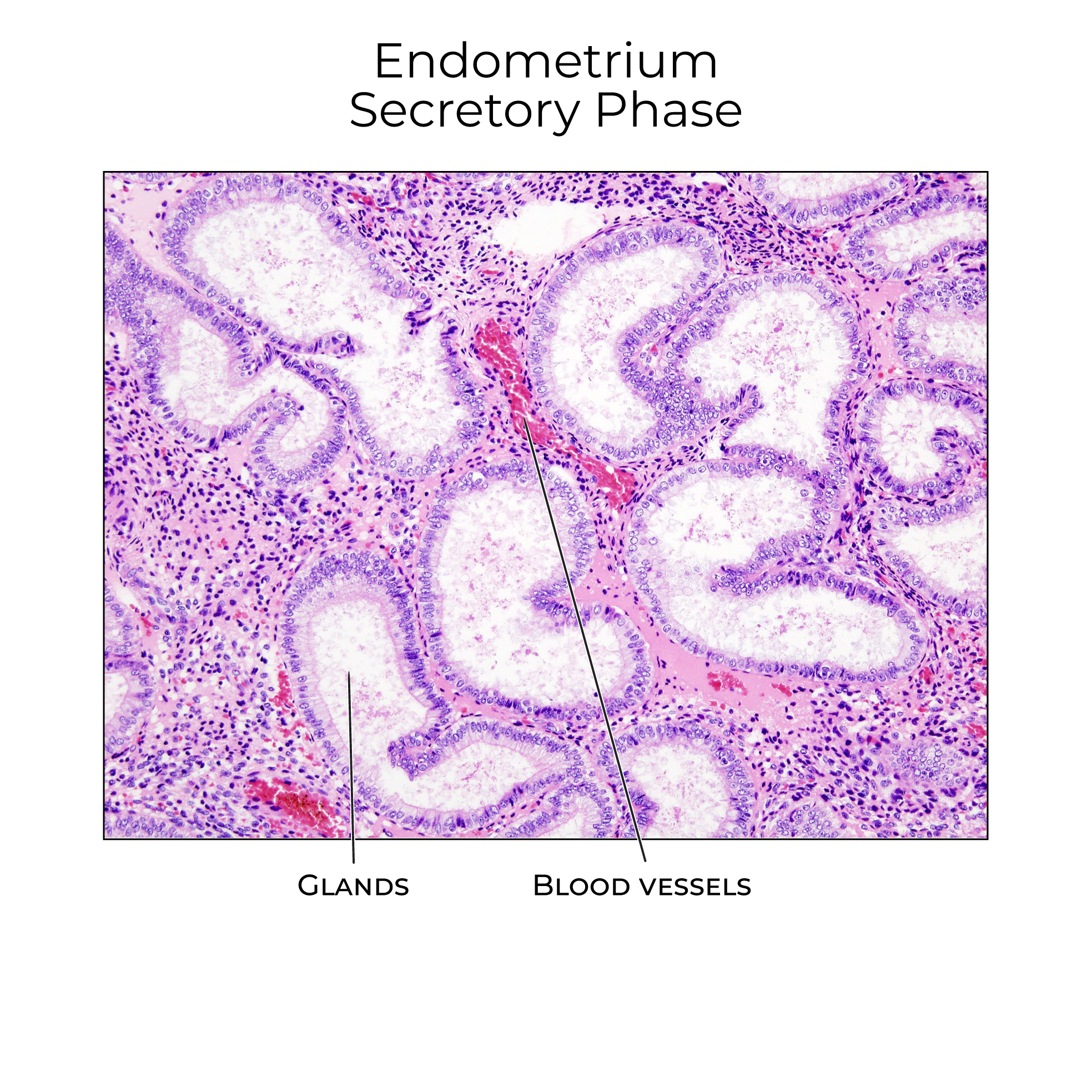 Endometrium, Secretory Phase