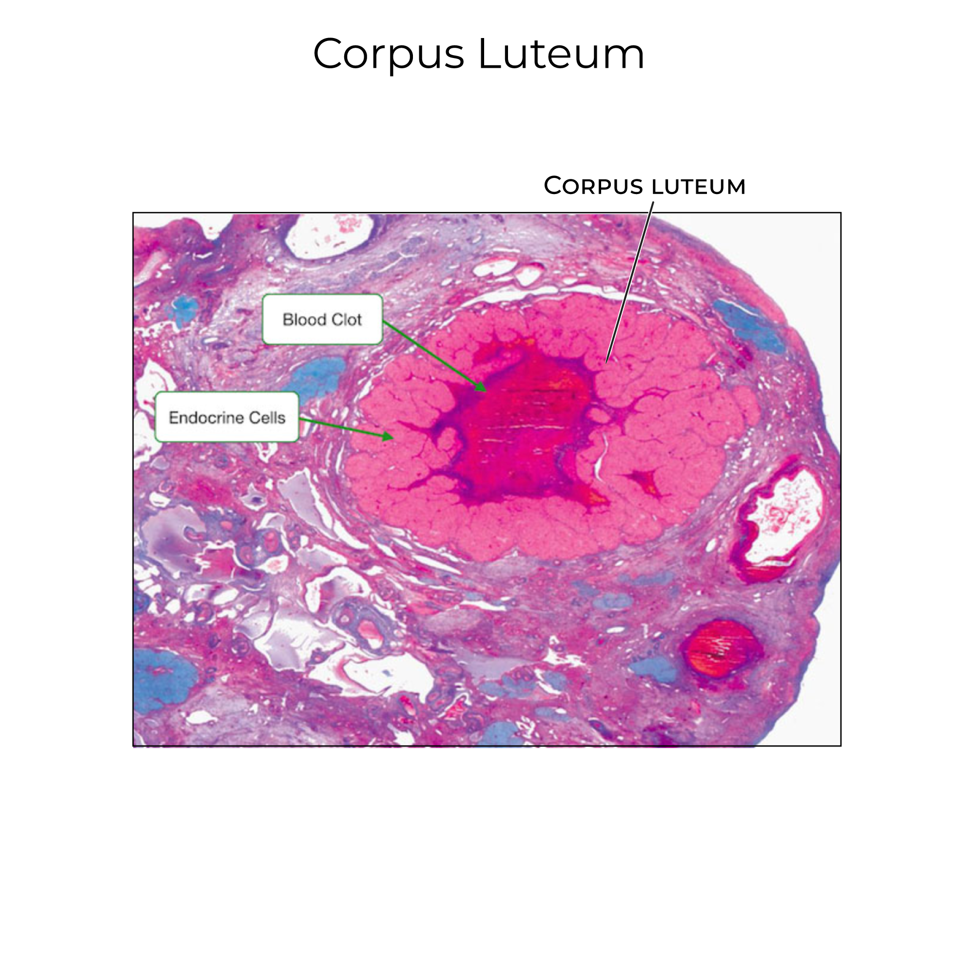 Corpus luteum